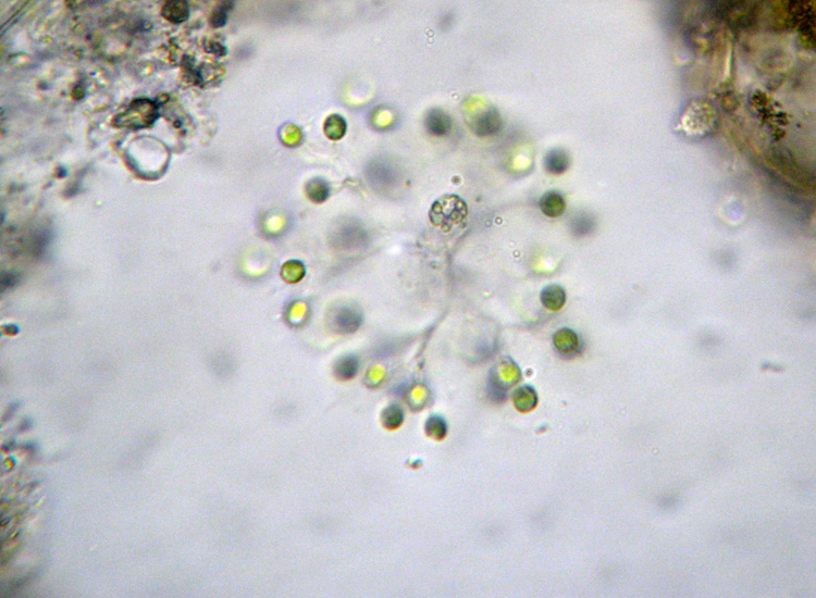 Forse Mucidosphaerium pulchellum [ Dictyosphaerium sp. ]